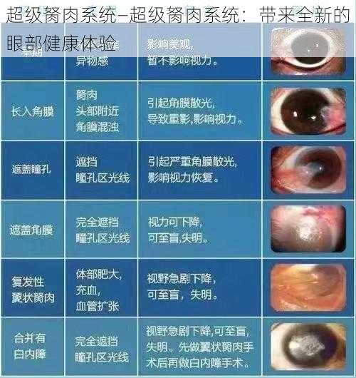 超级胬肉系统—超级胬肉系统：带来全新的眼部健康体验