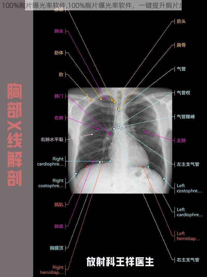 100%胸片曝光率软件,100%胸片曝光率软件，一键提升胸片成像效果